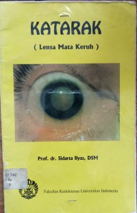 KATARAK : LENSA MATA KERUH